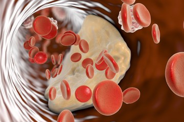 клетики крови и холестерин