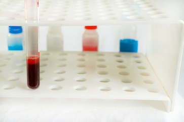 Биохимический анализ крови на креатинин и мочевину