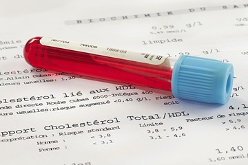 Пониженный холестерин в крови - что это значит?