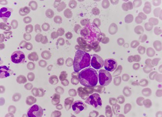 Базофилы (bas) в общем анализе крови