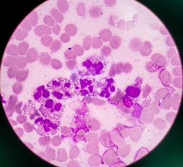 моноциты под микромкопом