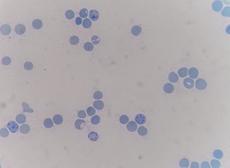 ретикулоциты под микроскопом