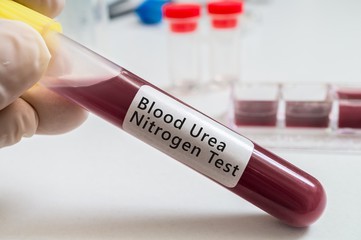 пробирка при анализе мочевины в крови