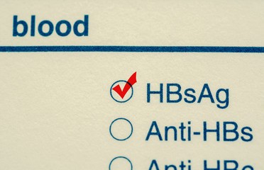 Анализ крови на HBsAG: что это значит, расшифровка результатов
