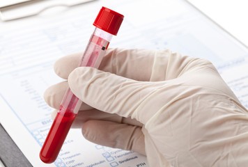 mcv в анализе крови: нормы и возможные причины отклонений