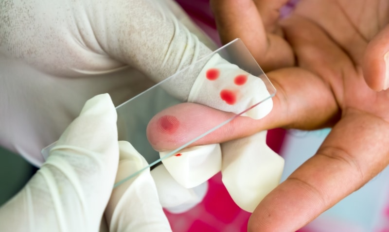 Анализ крови при анемии: причины возникновения, определение анемии по анализу крови