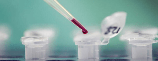 Анализ крови на паразитов: какой анализ сдавать и что он покажет?