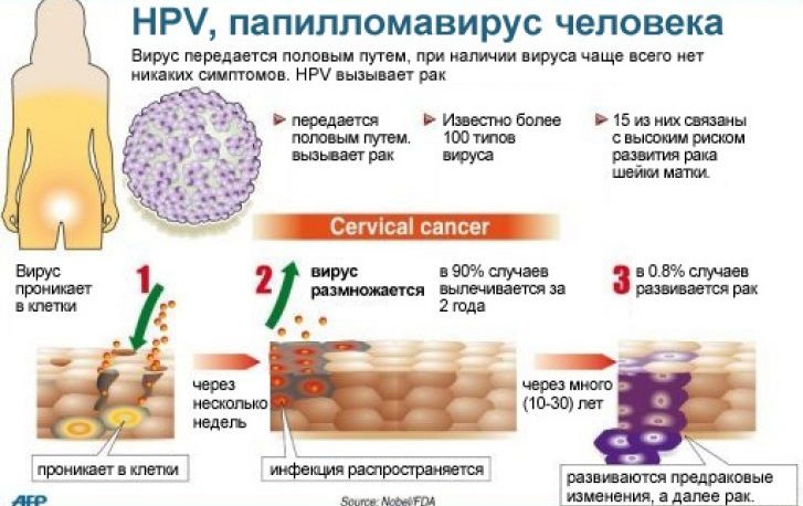 Анализ крови на ВПЧ (вирус папилломы человека): Что такое ВПЧ и способы диагностики