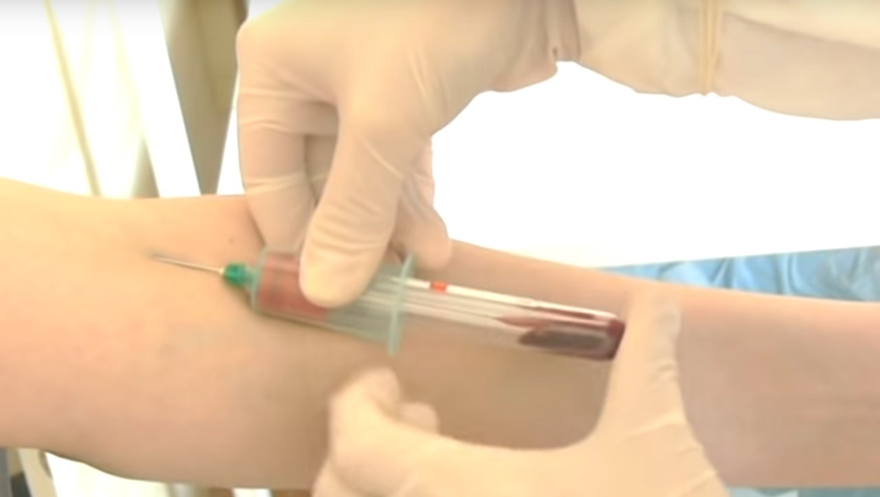 Что показывает биохимический анализ крови?